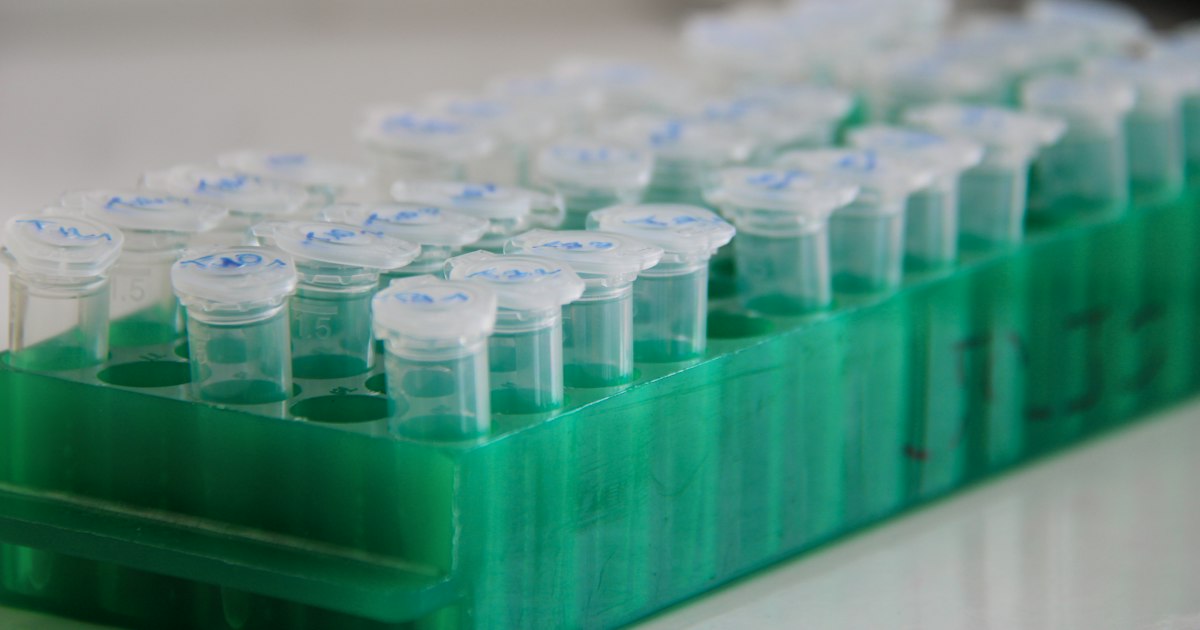 Alkaline phosphatase: what the test shows and why it matters for athletes