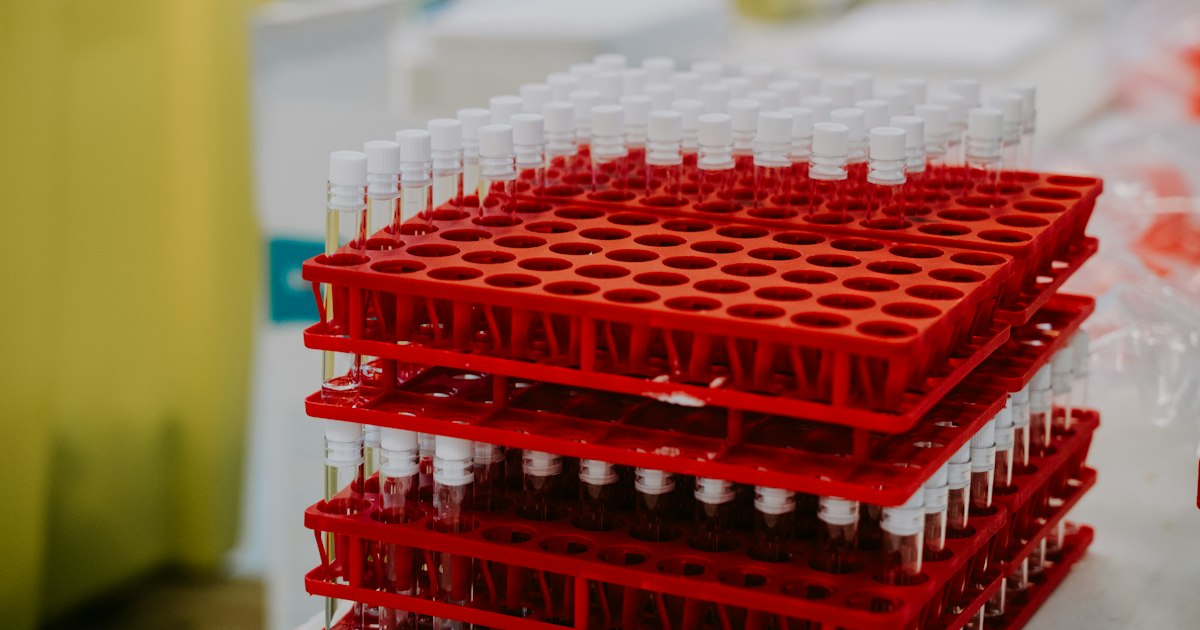 Alkaline phosphatase above or below normal: causes in athletes and what to do