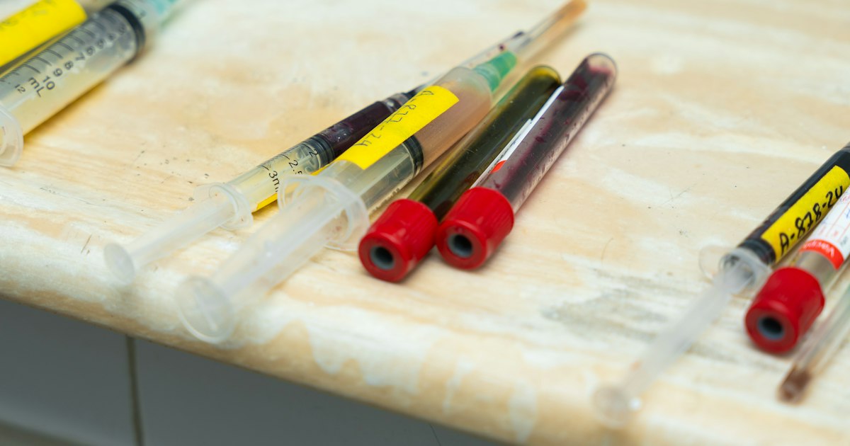 Glomerular filtration rate (GFR) above or below normal: causes in athletes and what to do